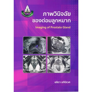 (ศูนย์หนังสือจุฬาฯ) ภาพวินิจฉัยของต่อมลูกหมาก (IMAGING OF PROSTATE GLAND) (9786165773102)