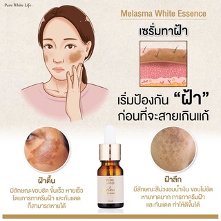 [ลด 50% ใส่โค้ด INCSM99 ] Purewhitelife - Melasma White Essence Serum เซรั่มลดฝ้า เซรั่มทาฝ้า กระ จุดด่างดำ 10g