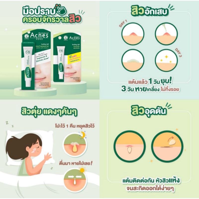 mentholatum-acnes-sealing-jell-acne-treatment-gel