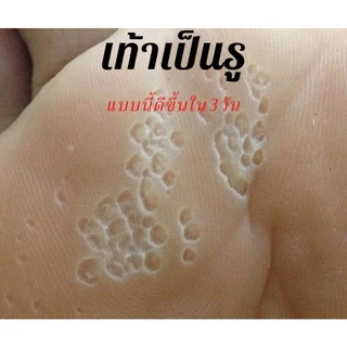 แป้งดับกลิ่นเท้า เท้าเหม็น เท้าเป็นรู