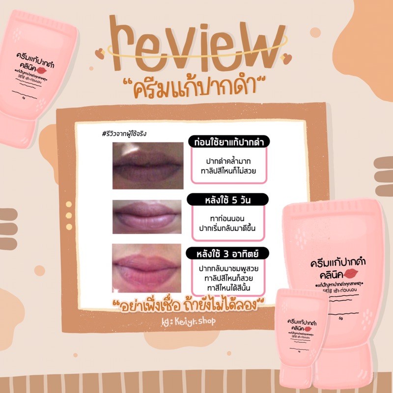 ครีมแก้ปากดำคลีนิค ยืนหนึ่งตัวช่วยลดปากดำกรรมพันธุ์ | Shopee Thailand