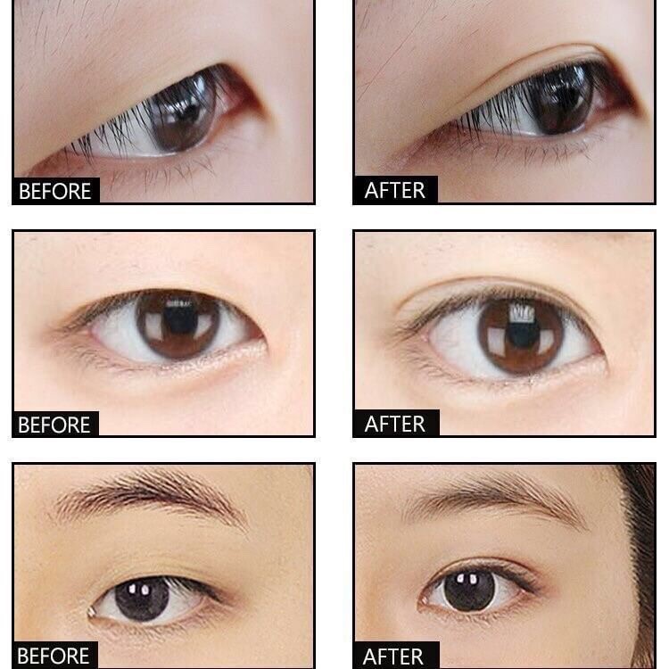 กาวทำตา 2 ชั้นพร้อมไม้ตัว Y - รูปที่ 3