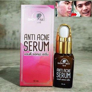Show Naii Anti Acne Serum 10ml.