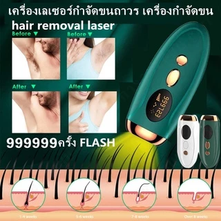 Luccica IPLเครื่องเลเซอร์กำจัดขน เครื่องกำจัดขนถาวร 999999 กำจัดขนไม่เจ็บปวด