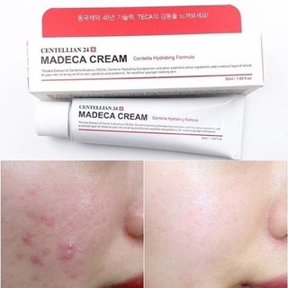 Centellian 24 Madeca Cream ครีมบำรุงผิวหน้า 15ml