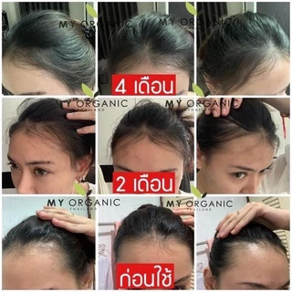 [โปรใหม่ ก.ค.] [ของแท้จากบริษัท] My Organic Hair M1 Hair Serum แฮเซรั่ม แก้ผมหงอก แก้ผมร่วง ผมบาง เซรั่มผม มายออร์