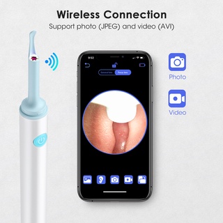 ชุดช้อนทําความสะอาดหู Endoscope HD 3.9 มม. สําหรับ Android IOS