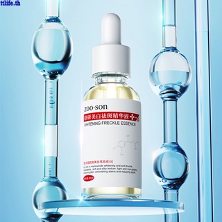 【ANDES】Whitening Freckle Facial Serum Dark Spot Corrector Powerful Removing Melasma Melanin Dark Spots Pigmentation Brightening Moisturizing Hydrating Face Essence Skin Care 30