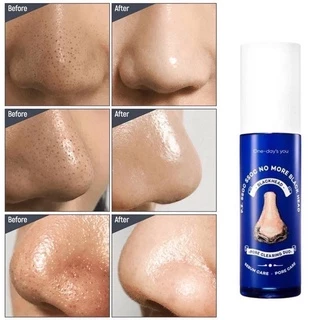 🌼โทนเนอร์กำจัดสิวเสี้ยนสิวหัวดำ One-day's you P.Z SSOC SSOC No More Blackhead 100 ml