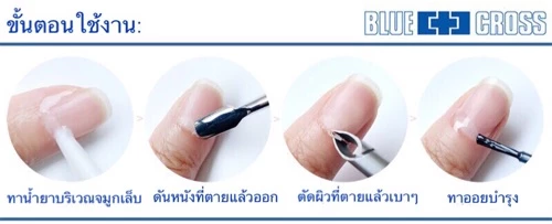 ✅BlueCross น้ำยาหนังนิ่ม ของแท้จากอเมริกา มีอย. Cuticle Remover | Made in USA 🔥 น้ำยาตัดหนัง
