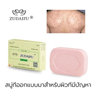 【zudaifu】สบู่กำมะถันแท้ 100% ฆ่าเชื้อใบหน้า อาบน้ำ อาบน้ำ สบู่ล้างมือ ต้านเชื้อแบคทีเรีย กำจัดไร บรรเทาอาการคัน