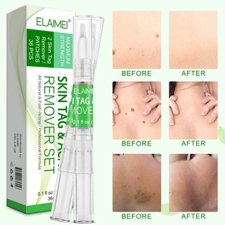 ELAMEI  Skin tag &amp; Acne remover set.ลบริ้วรอยดำ ฝี ขึ้แมงวัน ใช้ง่ายแค่แต้ม ขนาด3ml บรรจุ 2หลอด