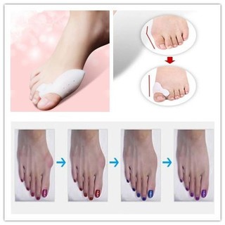 Medical Silica Gel Hallux Valgus Corrector Big Toe Separator