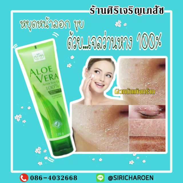 Vitara Aloe vera after sun gel 100%