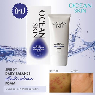 Ocean Skin Speedy Daily Balance Anti-Acne Foam 50ml / 150ml