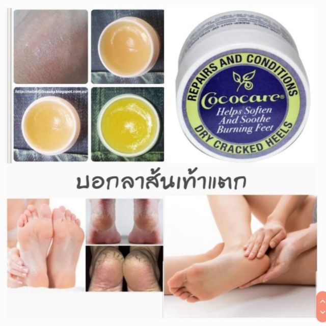 Cococare, Repairs and conditions dry cracked heels