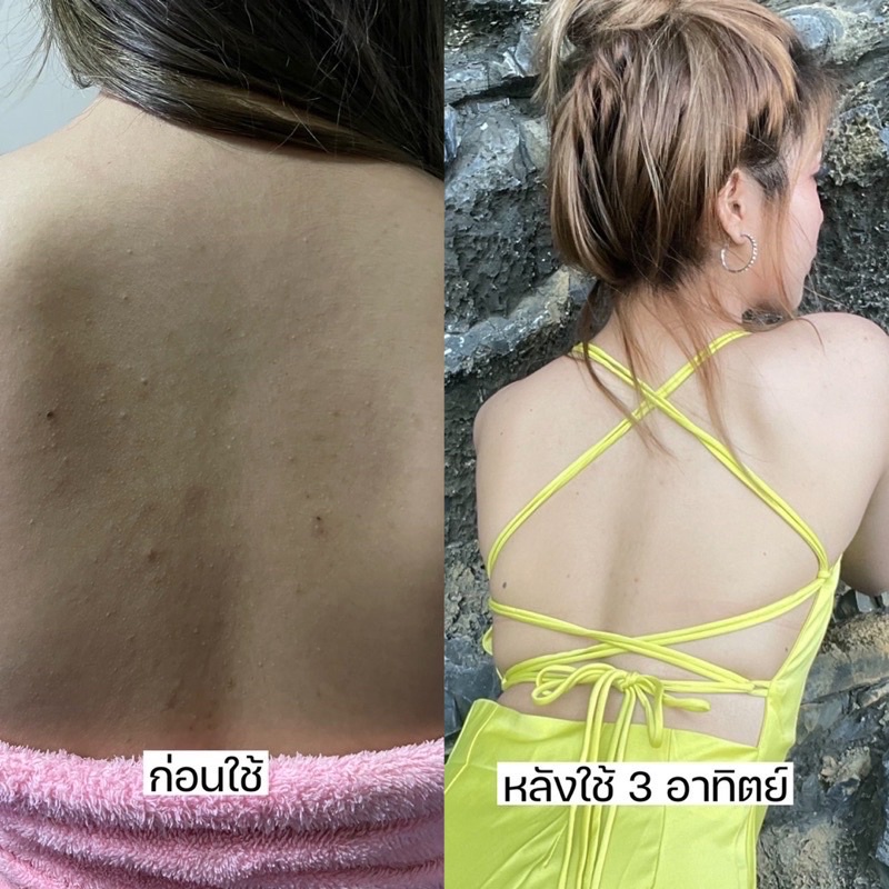 (มีส่งด่วน🚩) สบู่สาธิดา : สครับสาธิดา ช็อกโก้บาร์ขัดผิว ลดสิวที่หลัง ผิวขาว รูปที่ 4