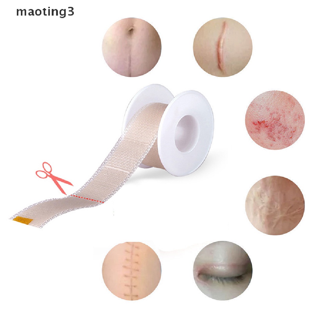 [maoting3] Efficient Surgery SelfAdhesive Silicone Gel Tape Trauma