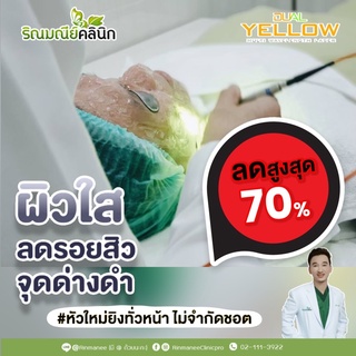 Dual yellow เลเซอร์หน้าใส ลดฝ้า กระ ลบรอยดำ รอยแดงจากสิว  เห็นผลตั้งแต่ครั้งแรกที่ทำ คูปองไม่มีวันหมดอายุ