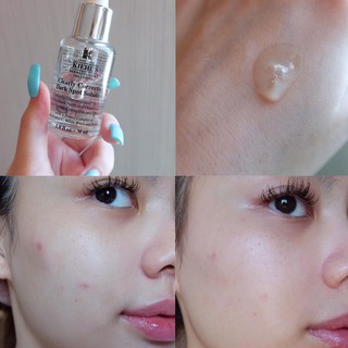 คีลส์ แก้ไขรอยดำ Clearly Corrective Dark Spot Solution30ml.