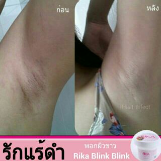 รักแร้ขาวเนียน ลดตุ่มหนังไก่ Rika Blink Blink 45g.