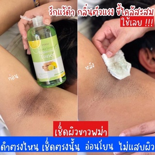 ‼️💚ของแรงขายดีมาก💚‼️โทนเนอร์PAMA สูตรเลมอนทานาคา เช็ดผิวหน้าผิวกาย คอดำขาหนีบดำรักแร้ดำ ฝังลึก