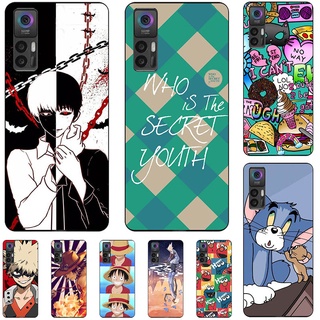 เคสโทรศัพท์มือถือ ซิลิโคนนิ่ม ลายการ์ตูนอะนิเมะน่ารัก แฟชั่น สําหรับ TCL 30 Plus 30+ TCL 30 5G T776H 4G T676H