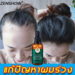 เซรั่มขิงบำรุงผม 30ml สดชื่นควบคุมความมัน รากผมแข็งแรง ซ่อมแซมผมเสีย เซรั่มแก้ผมร่วง เซรั่มปลูกผม เซรั่มบำรุงผม