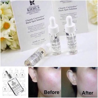 Kiehls dermatologist solutions Clearly Corrective Dark Spot Solution 4 ml