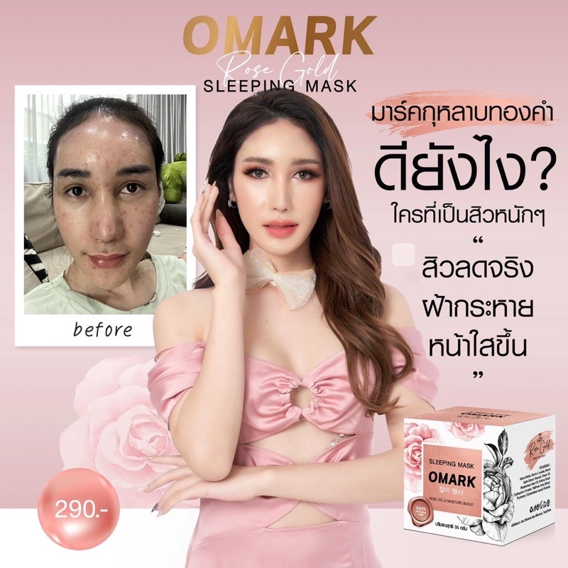OMark Sleepingmark(โอมาร์คบาสตี้)