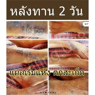 🌱อัลฟัลฟ่า​ Alflafa​🎖️ของแท้💯% มีรีวิว​จริง👍💥ล้างพิษ​ สร้างภูมิ ผิวใส​ ผิวขาว​ ดี​ท็อกซ์​ detox​ กรดไหลย้อน​ อัลฟาฟ่า