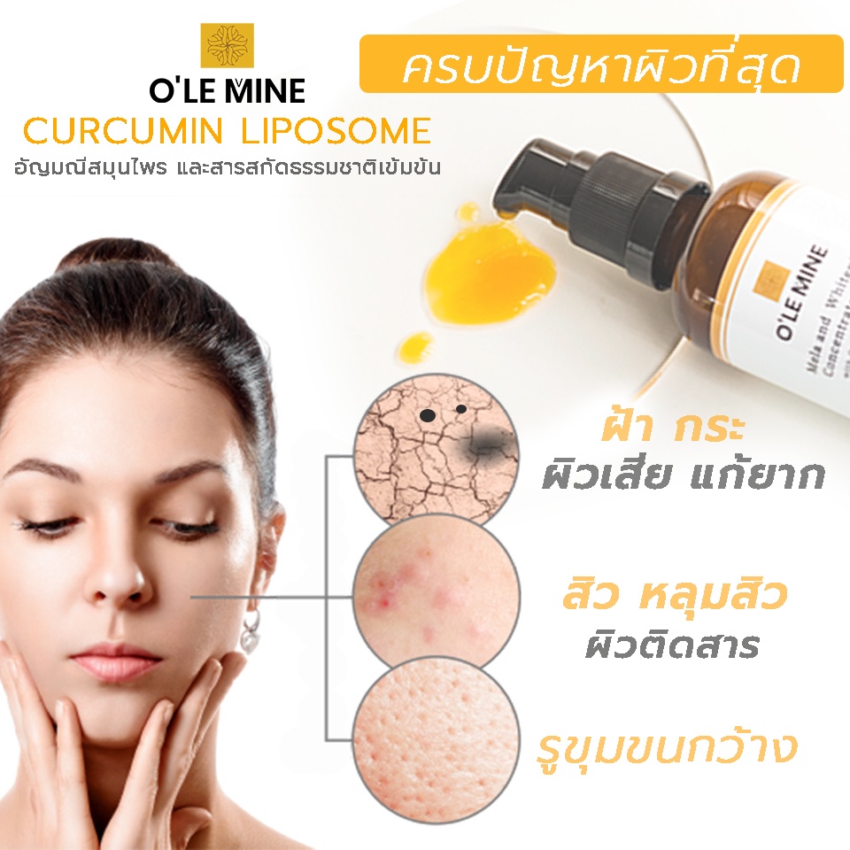 ฝ้าหนา รูขุมขนกว้าง ลดด้วย O’Lemine & Te emzelle serum ราคา ถูกที่สุด ดีลบีเคเค แกลเลอรีภาพที่ 8