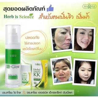 ดร.สาโรช ไฮโกล โลชั่น รักษาฝ้า สำหรับ หน้ามันมาก x2 Hi glow