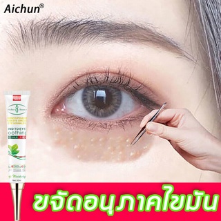 เซรั่มทาถุงใต้ตา เม็ดไขมัน 30ml ขจัดถุงใต้ตาอย่างเห็นได้ชัด อายครีม เม็ดไขมัน ครีมไต้ตา ครีมทาใต้ตาดำ บำรุงสายตา