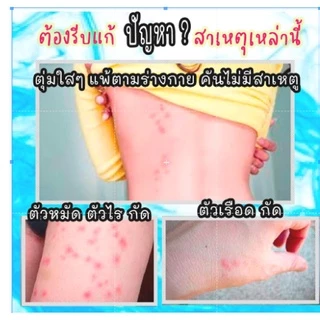 สเปรย์ไล่ ตัวเรือด (ขนาด ลิตร) (RR-1) สมุนไพรป้องกันตัวเรือด ตัวริ้น ตัวไร ไรฝุ่น ตัวเหา เห็บหมัดบนที่นอน โซฟา