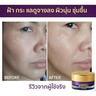 🔥โปรเซ็ต 2 ชิ้น‼️ ของแท้💯 VIV SKIN เซ็ตขมิ้น สูตร ORIGINAL (เซรั่ม + ครีม) วิฟสกิน ครีมจุ๋ย