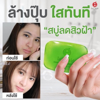 [ไม่เห็นผลยินดีคืนเงิน💯] ลาชูเล่ สบู่สลายฝ้า หน้าใส ลดผิวติดสาร นาโน ไวท์เทนนิ่ง โซฟ จีพีโฟร์จี 60 กรัม