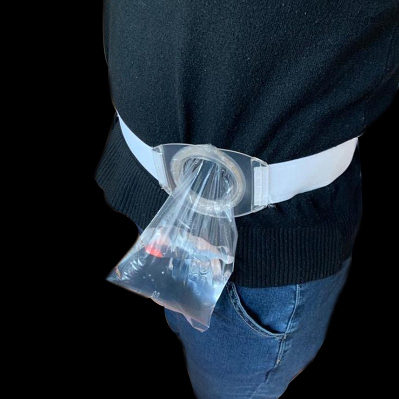 2pcs Colostomy Ostomy เข็มขัด/Ostoma เอวซิลิโคน Stoma วงกลมเข็มขัด + 80 ชิ้น Ostomy กระเป๋าหลังจาก Coลอสโตmy Iliostomy กระเป๋า - รูปที่ 7