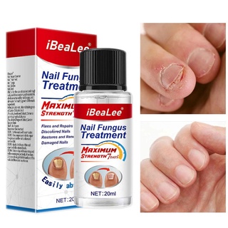 Ibealee Onychomycosis ครีมกําจัดแบคทีเรีย เล็บนุ่ม หนาพิเศษ