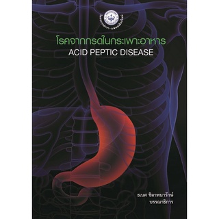 (ศูนย์หนังสือจุฬาฯ) โรคจากกรดในกระเพาะอาหาร (ACID PEPTIC DESEASE) (9786165884945)