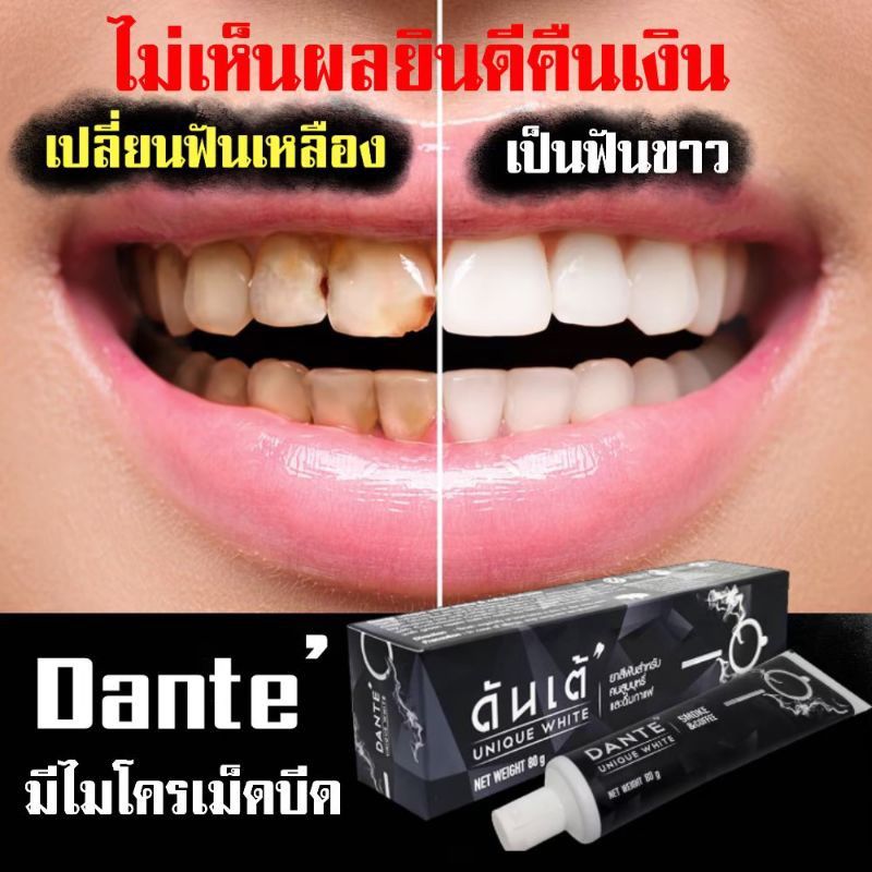 ยาสีฟัน ดันเต้ Dante ขจัดคราบหินปูน ฟันเหลือง คราบกลิ่บุรี่ ทำให้ฟันขาว สะอาด ระงับกลิ่นปาก ลมหาใจขา