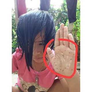 แชมพูเหา+หวีสางสแตนเลส 1ด้าม สูตรสมุนไพร กลิ่นหอม อ่อนโยน 1ขวบใช้ได้