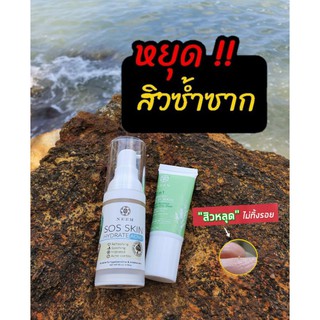 ปราบสิวจากแมสก์ Neem เช็ตเดียวจบปัญหาเรื้อรัง (Sos Skin + 2in1Teatoc) by Neem natural