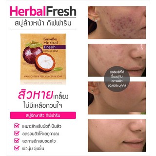 ฟรีถุงตีฟอง สบู่มังคุดลดสิว-รอยสิว ช่วยให้หน้าใสไร้สิว ใช้ดีมาก (พร้อมส่ง)