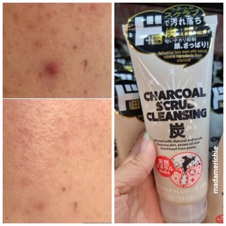 โฟมล้างหน้า ลดสิวdetox chacoal scrub cleansing โฟมล้างหน้าญี่ปุ่น