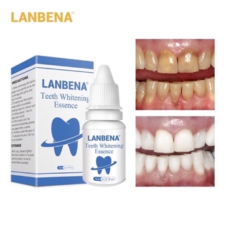 เซรั่มไวท์เทนนิ่งสำหรับฟอกฟันขาว (Lanbena) Teeth Whaitening Essence