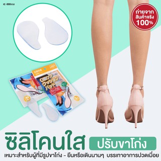 ซิลิโคนเจลรองเท้าสำหรับผู้ที่เดินขาโก่งขาผิดรูป 4 ชิ้น/ 2 คู่