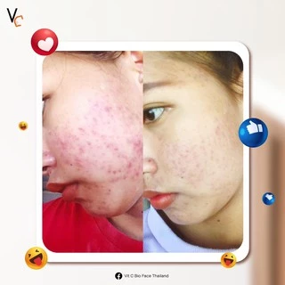 Vit C bio face serum VC เซรั่มวิตามินซี วิตซีน้องฉัตร 10 ml. (ของแท้100%)