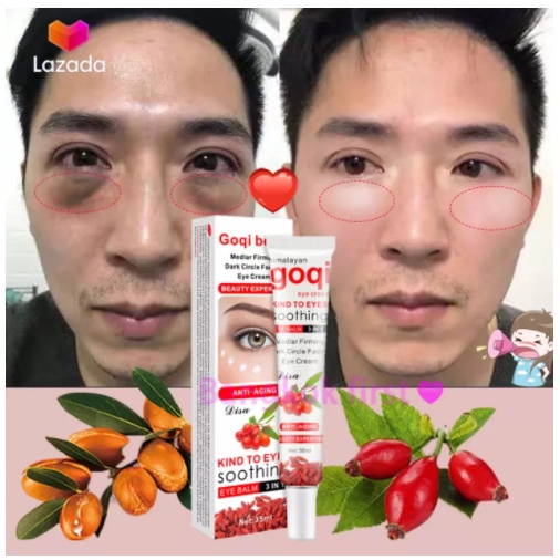 ครีมบำรุงรอบดวงตา 35ml อายครีม ลดใต้ตาดำ เพิ่มความชุ่มชื้น ครีมทาใต้ตาดำ eyecream Aichun ครีมบำรุงใต