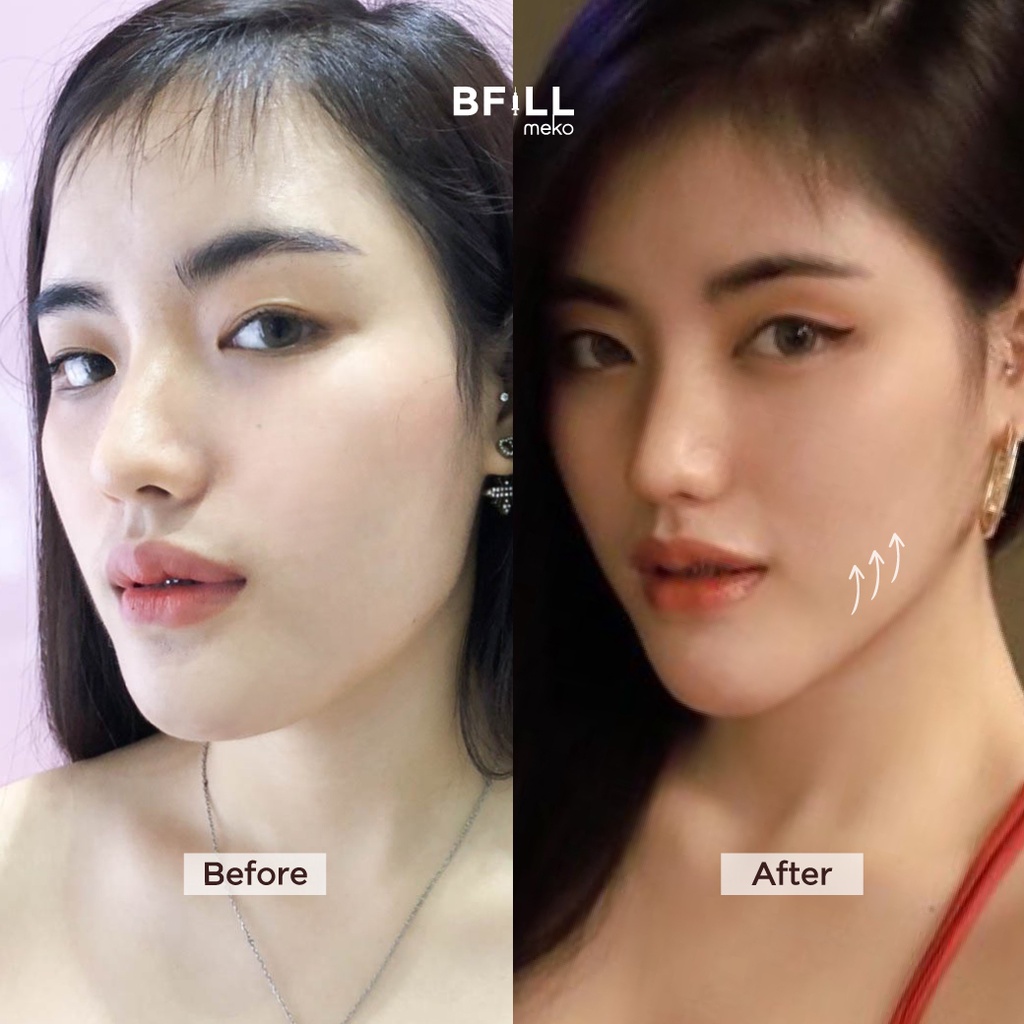 Premium Hifu By Doctor พรีเมียม ไฮฟู่ ทำโดยคุณหมอ